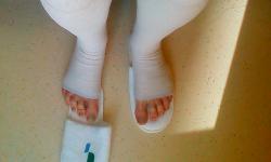 Featured image of post Про операцию